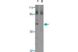 Western blot analysis of RBM35A in rat colon tissue lysate with RBM35A polyclonal antibody  at 0. (ESRP1 抗体  (N-Term))