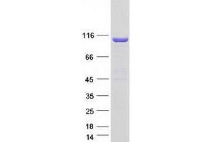 Western Blotting (WB) image for PTK2B Protein tyrosine Kinase 2 beta (PTK2B) (Transcript Variant 4) protein (Myc-DYKDDDDK Tag) (ABIN2720717)