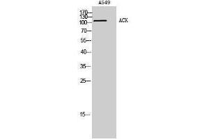 Western Blotting (WB) image for anti-tyrosine Kinase, Non-Receptor, 2 (TNK2) (Tyr530) antibody (ABIN3178052) (TNK2 抗体  (Tyr530))
