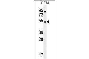 TBC1D13 Antibody (Center) (ABIN655819 and ABIN2845243) western blot analysis in CEM cell line lysates (35 μg/lane). (TBC1D13 抗体  (AA 76-105))