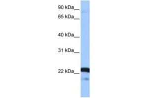 Western Blotting (WB) image for anti-serine/arginine-Rich Splicing Factor 9 (SFRS9) antibody (ABIN2462154) (SFRS9 抗体)