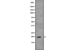 Western blot analysis of TCAP expression in Fetal muscle lysate Fetal heart lysate,The lane on the left is treated with the antigen-specific peptide. (TCAP 抗体  (N-Term))