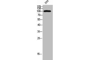 Western Blot analysis of 293 cells using KIF20A Polyclonal Antibody (KIF2A 抗体)