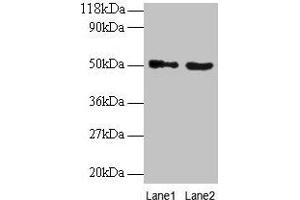 Western blot All lanes: VOPP1 antibody at 2 μg/mL Lane 1: EC109 whole cell lysate Lane 2: 293T whole cell lysate Secondary Goat polyclonal to rabbit IgG at 1/15000 dilution Predicted band size: 20, 19, 18 kDa Observed band size: 50 kDa (VOPP1 抗体  (AA 23-172))