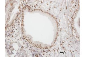 Immunoperoxidase of monoclonal antibody to IFI16 on formalin-fixed paraffin-embedded human prostate. (IFI16 抗体  (AA 630-729))