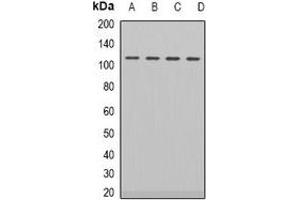 Western blot analysis of Androgen Receptor expression in HEK293T (A), LOVO (B), NIH3T3 (C), PC12 (D) whole cell lysates.