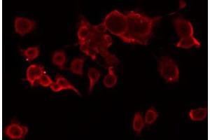 ABIN6274805 staining Hela by IF/ICC. (ACOT2 抗体  (Internal Region))