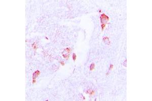 Immunohistochemical analysis of CSRNP2 staining in human brain formalin fixed paraffin embedded tissue section. (CSRNP2 抗体  (Center))