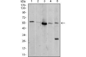Western Blotting (WB) image for anti-V-Akt Murine Thymoma Viral Oncogene Homolog 1 (AKT1) (AA 1-150) antibody (ABIN5856183) (AKT1 抗体  (AA 1-150))