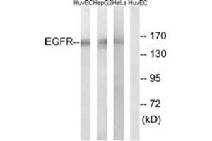 Western blot analysis of extracts from HuvEc/HepG2/HeLa cells, using EGFR (Ab-1071) Antibody. (EGFR 抗体  (AA 1036-1085))