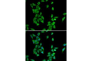 Immunofluorescence analysis of HeLa cells using ANXA4 antibody (ABIN6290015). (Annexin IV 抗体)