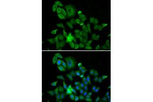 Immunofluorescence analysis of A549 cell using HMMR antibody. (HMMR 抗体  (AA 341-440))