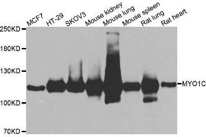 Western blot analysis of extracts of various cell lines, using MYO1C antibody. (Myosin IC 抗体)