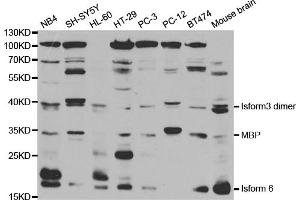 Western blot analysis of extracts of various cell lines, using MBP antibody. (MBP 抗体)