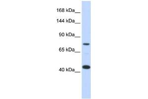 WB Suggested Anti-LRP8 Antibody Titration:  0. (LRP8 抗体  (Middle Region))