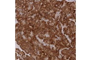 Immunohistochemical staining of human pancreas with ARHGEF10L polyclonal antibody  shows strong cytoplasmic positivity in exocrine cells at 1:10-1:20 dilution. (ARHGEF10L 抗体)