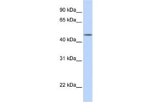 WB Suggested Anti-TBL2 Antibody Titration: 0. (TBL2 抗体  (N-Term))