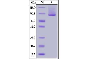 Human Glypican 1, His Tag on  under reducing (R) condition. (GPC1 Protein (AA 24-530) (His tag))