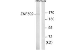 Western blot analysis of extracts from K562 cells, using ZNF592 Antibody. (ZNF592 抗体  (AA 961-1010))