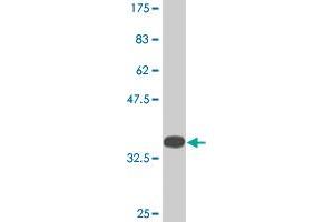 Western Blot detection against Immunogen (35. (KDM5B 抗体  (AA 231-319))