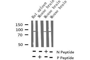 Western Blotting (WB) image for anti-Protein Kinase C (pan) (PKC pan) (pThr497) antibody (ABIN6256576)