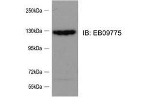 Western Blotting (WB) image for anti-SLIT-ROBO rho GTPase Activating Protein 2 (SRGAP2) (Internal Region) antibody (ABIN2464859) (SRGAP2 抗体  (Internal Region))