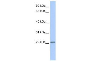 TRAPPC5 antibody used at 1 ug/ml to detect target protein. (TRAPPC5 抗体  (Middle Region))