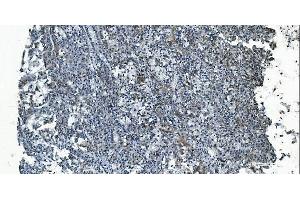 IHC analysis of MCU using anti-MCU antibody (ABIN7601931).