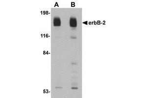 Western blot analysis of erbB-2 in rat liver tissue lysate with AP30319PU-N erbB-2 antibody at (A) 1 and (B) 2 μg/ml. (ErbB2/Her2 抗体  (C-Term))