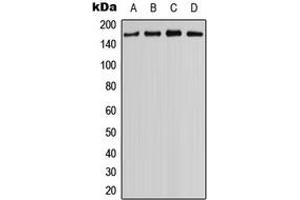 Western blot analysis of MYO3B expression in NCIH460 (A), HEK293T (B), mouse eye (C), rat kidney (D) whole cell lysates. (MYO3B 抗体  (C-Term))