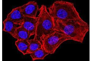 Immunofluorescence analysis of Hela cells using NS1 mouse mAb. (Parvovirus B19 NS1 (AA 1-216) 抗体)