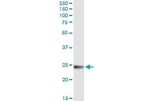 Immunoprecipitation of WISP2 transfected lysate using anti-WISP2 MaxPab rabbit polyclonal antibody and Protein A Magnetic Bead , and immunoblotted with WISP2 MaxPab mouse polyclonal antibody (B01) . (WISP2 抗体  (AA 1-250))