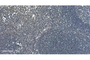 IHC analysis of LSM7 using anti-LSM7 antibody (ABIN7598937). (LSM7 抗体  (AA 1-103))
