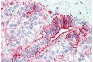 Immunohistochemistry (IHC) image for anti-CD44 (CD44) antibody (ABIN396970)