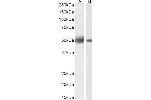 Western Blotting (WB) image for anti-Septin 4 (SEPT4) (AA 33-44) antibody (ABIN571249)
