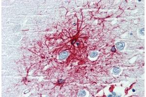 Immunohistochemistry staining of human brain cortex (paraffin-embedded sections) with anti-GFAP (clone GF-01). (GFAP 抗体)