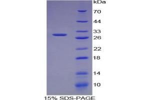SDS-PAGE analysis of Human Chordin Protein. (Chordin Protein (CHRD))