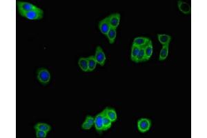 Immunofluorescent analysis of HepG2 cells using ABIN7156344 at dilution of 1:100 and Alexa Fluor 488-congugated AffiniPure Goat Anti-Rabbit IgG(H+L) (IDE 抗体  (AA 501-800))