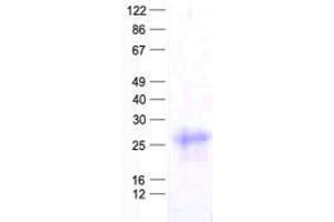 Validation with Western Blot (FBXO32 Protein (His tag))