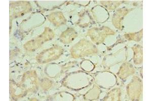 Immunohistochemistry of paraffin-embedded human kidney tissue using ABIN7149543 at dilution of 1:100 (CRADD 抗体  (AA 1-199))