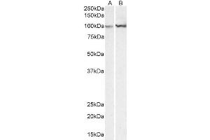 ABIN2613374 (0. (ACTN1 抗体  (AA 596-609))