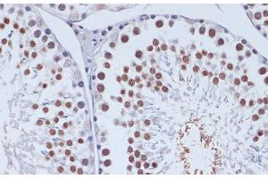 Immunohistochemistry of paraffin-embedded Rat testis using DNMT3L Polyclonal Antibody at dilution of 1:100 (40x lens). (DNMT3L 抗体)