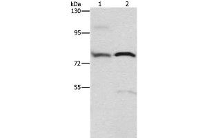 Western Blot analysis of 293T cell and Human fetal brain tissue using ATXN1 Polyclonal Antibody at dilution of 1:800 (Ataxin 1 抗体)