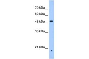 Western Blotting (WB) image for anti-Zinc Finger, DHHC-Type Containing 16 (ZDHHC16) antibody (ABIN2463313) (ZDHHC16 抗体)