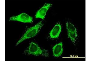 Immunofluorescence of purified MaxPab antibody to SLC25A3 on HeLa cell. (SLC25A3 抗体  (AA 1-361))