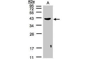 WB Image Sample(30 μg of whole cell lysate) A:Raji, 12% SDS PAGE antibody diluted at 1:500 (Pleckstrin 抗体  (C-Term))