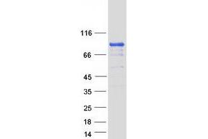 Validation with Western Blot
