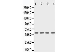 Anti-p53R2 antibody, Western blotting Lane 1: Rat Thymus Tissue Lysate Lane 2: MCF-7 Cell Lysate Lane 3: A431 Cell Lysate Lane 4: HELA Cell Lysate (RRM2B 抗体  (C-Term))