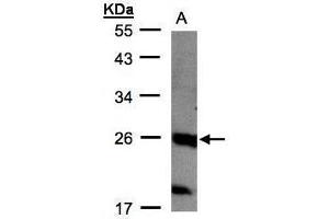 WB Image Sample(30 μg of whole cell lysate) A:MOLT4, 12% SDS PAGE antibody diluted at 1:1000 (C1orf57 抗体  (C-Term))