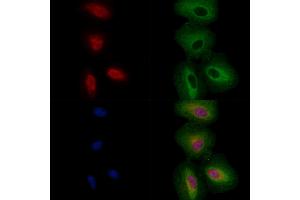 ABIN6256860 and ABIN6274329 staining  cells by IF/ICC. (FOXC1 抗体  (Internal Region))
